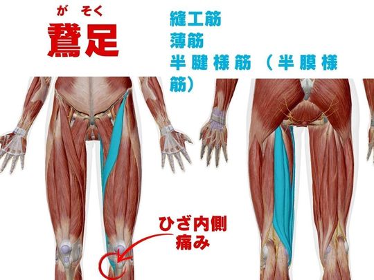 筋肉痛 膝の内側の痛み原因は？【鵞足】筋肉ほぐしで解消 動画解説あり - 40歳
